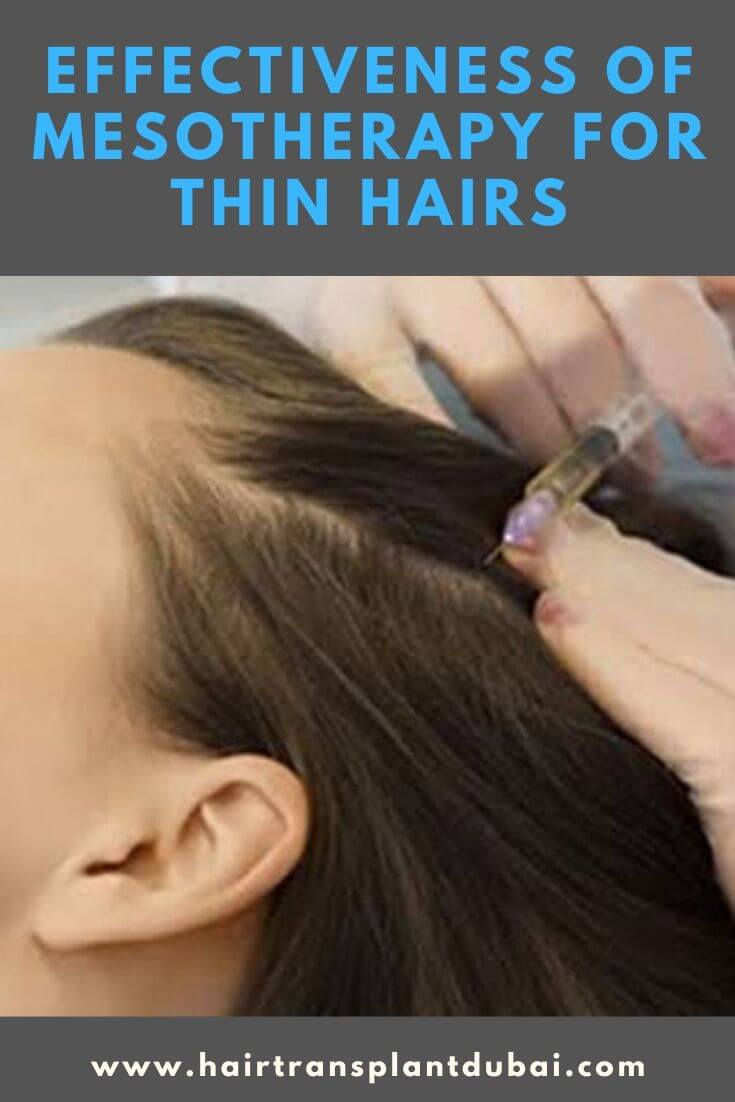 effectiveness-of-mesotherapy-for-thin-hairs