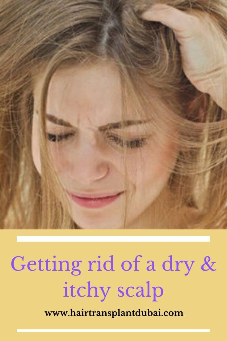 how-to-get-rid-of-a-dry-itchy-scalp