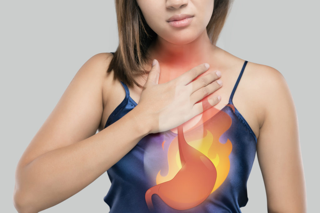 What Can Heartburn Be a Sign Of?