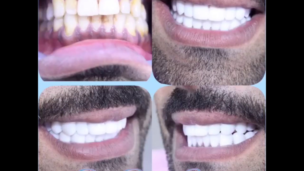 top-dental-clinic-dubai-cosmetic-dentistry-uae