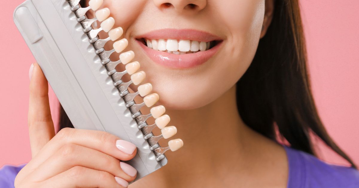 How Do Veneers Work on Teeth? An Overview