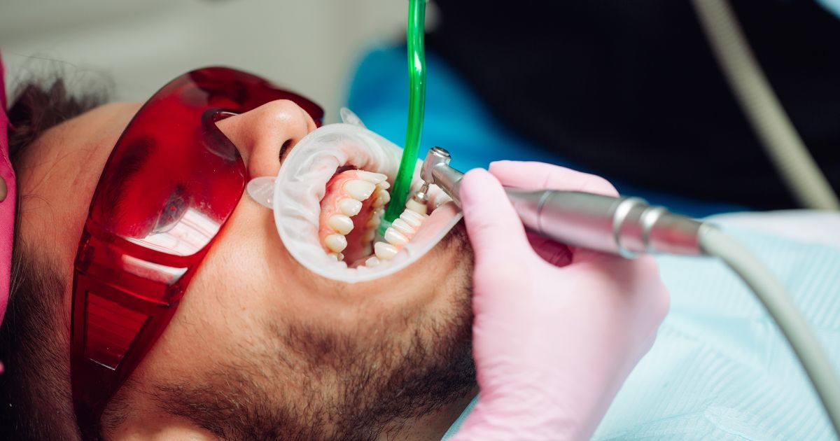 Professional Cleaning_ Safeguarding Veneers Through Regular Dental Visits